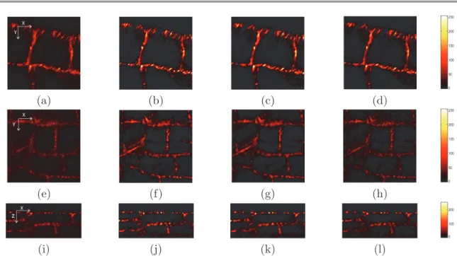 Figure 6. Blind restoration results on the test image D: a plant root image provided by G