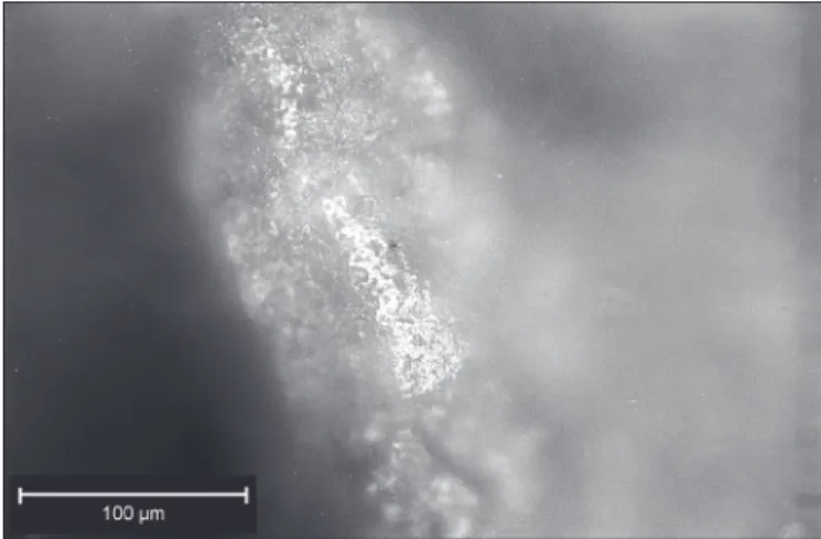 Fig. 13 – Le Pirou : traces d’emmanchement sur la face supérieure  du grattoir n o  213 (photo prise en a fig