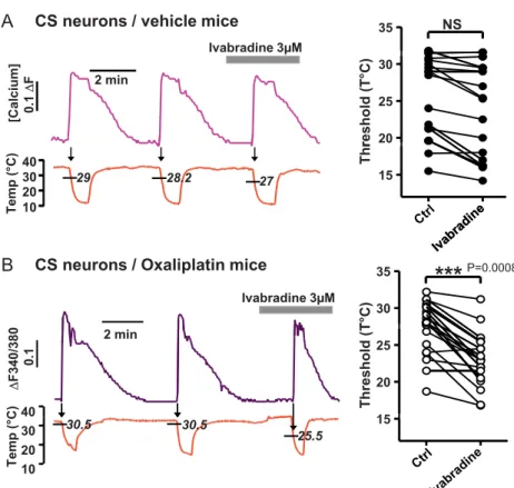 Figure 9. Effect of ivabradine on cold-sensitive DRG neurons thresholds.