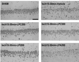 FIG. 6. Representative photomicrographs highlighting the ef- ef-fects of different LPLs (lysophosphatidylcholine [LPC],  lysophos-phatidylinositol [LPI], and lysophosphatidic acid [LPA]) injected 30 minutes following the end of the ischemic period on  morp