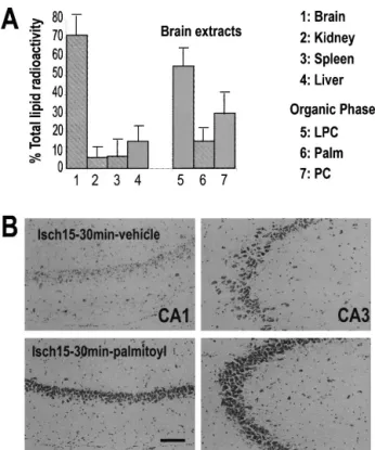 FIG. 9. Analysis of 1-[1– 14 C]-palmitoyl-LPC transport across the blood–brain barrier