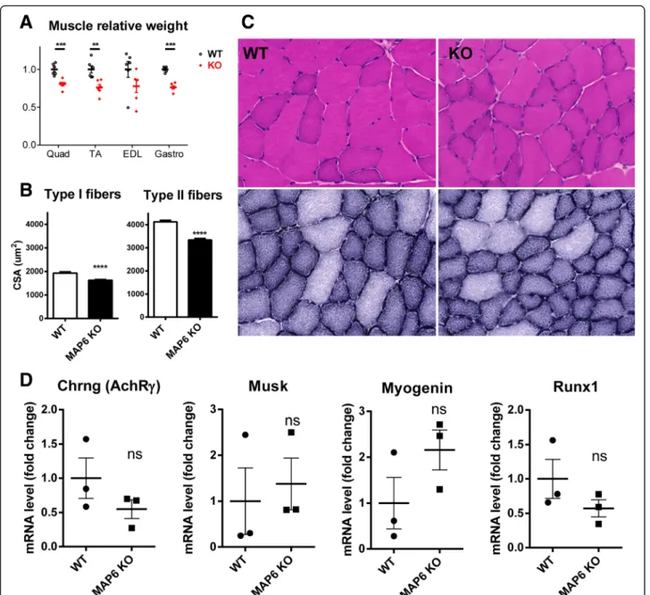 Fig. 2 Characterization of MAP6 KO skeletal muscles. a The weight of different muscles was measured from three WT and three MAP6 KO mice and normalized to weight of WT muscles