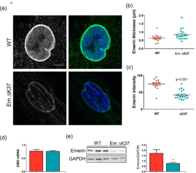 Figure 2. Mutation ΔK37, most commonly found in patients with atrial cardiac defects (ACD), causes  emerin degradation in cells grown on hard substrate