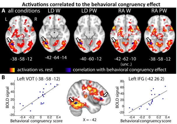 Fig. 4: A. Positive correlation between reading activations vs. rest and individual behavioral sensitivity to congruency, in the VOT cortex  (blue), overlaid on overall activations vs