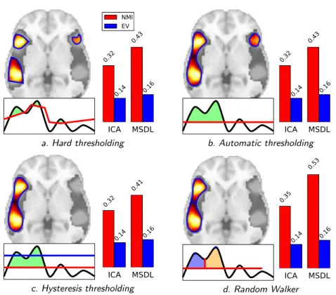Figure 2. Comparison of region extraction methods (after selection of 2 k regions). Brain maps obtained with MSDL are located on the left