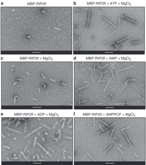 Fig. 2 Full-length RIP2 ﬁ laments are promoted by nucleotide binding. a – c Negative-stain micrographs of MBP-RIP2 ﬂ ﬁ laments obtained from (a) MBP- MBP-RIP2 ﬂ alone, (b) MBP-RIP2 ﬂ plus ATP dissolved in magnesium chloride buffer, (c) MBP-RIP2 ﬂ plus magn