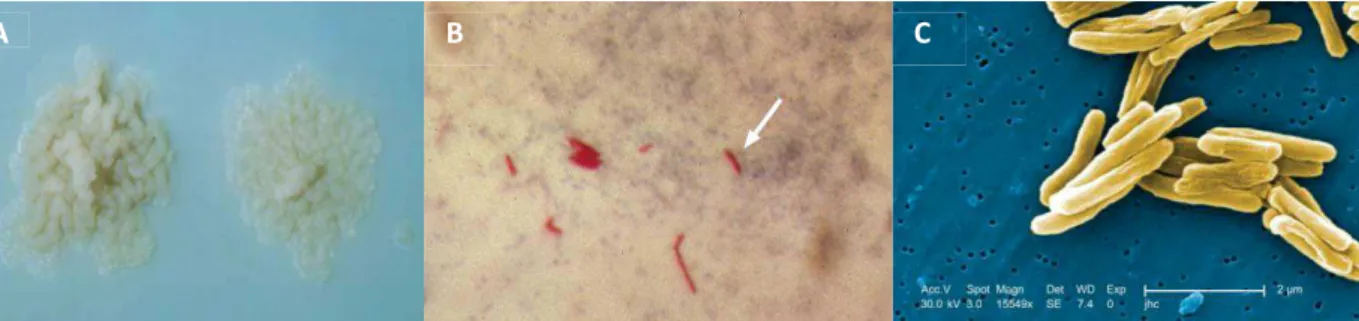 Figure 1. 4 M. tuberculosis colonies on Lowenstein-Jensen medium (A); M. tuberculosis stained by  Ziehl – Neelsen method (B) and M