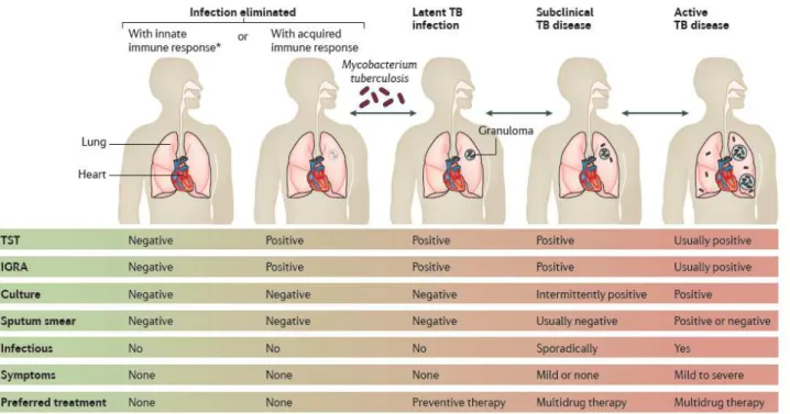 Figure 1 . TB spectrum from Mycobacterium tuberculosis infection to active (pulmonary) TB disease, from: Pai M,  et al