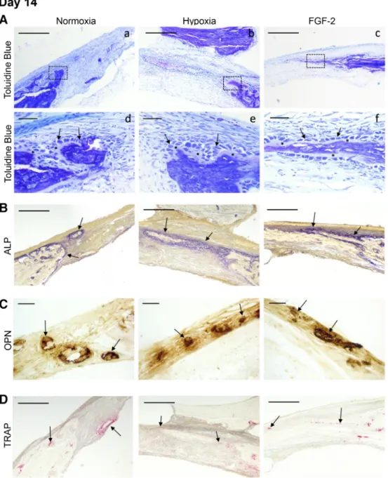 Figure 6. Characterization of the bone healing process at day 14. (A): Representative images of resin embedded calci ﬁ ed sections stained with toluidine blue revealing, for all the conditions, new bone formation (in purple) at both the edge and the center