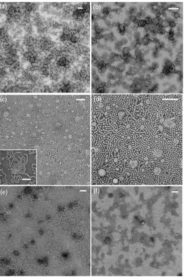 Figure 7. PEO-PBD/DPPC mixed LUV: TEM.  Representative TEM micrographs of: (a)PBD- (a)PBD-PEO  and  (b)  DPPC  nanometric  vesicles;  (c-f)  PBD-(a)PBD-PEO/DPPC  hybrid  nanometric  assemblies  containing (c, d) 35% DPPC and (e, f) 65% DPPC molar ratios