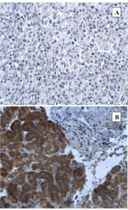Fig 2. NS3 immunostaining in controls. A: Negative staining in a DLBCL biopsy from a HCV negative patient