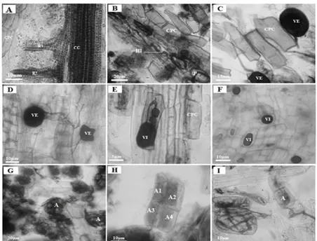 Figure 3.— Écrasements racinaires de Pistacia atlantica ; A- Ramifications racinaires (R) à partir du cylindre central (CC)  avec les cellules du parenchyme cortical (CPC) (Station de Ain-Ouassara, été)