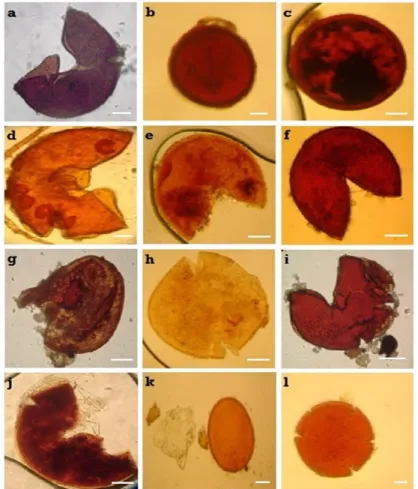 Figure 5.— Spores de différentes espèces de CMA isolées de la rhizosphère de P. atlantica des différentes stations