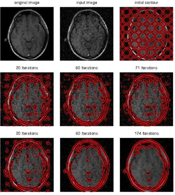 Figure 4: Top row: original, noisy image with Gaussian noise (variance = 0.2) and initial contour
