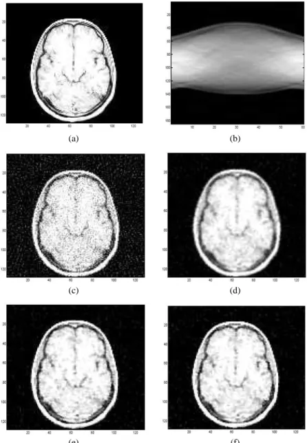 Figure 6. Reconstruction of a brain image: (a) original image; (b) noisy sinogram (SNR=24); reconstructed images by: (c) FBP (PSNR=24.19, SSIM=0.31); (d) FBP +  Ham-ming filter (PSNR=26.71, SSIM=0.61); (e) topological gradient + TV norm (PSNR=33.47, SSIM=0