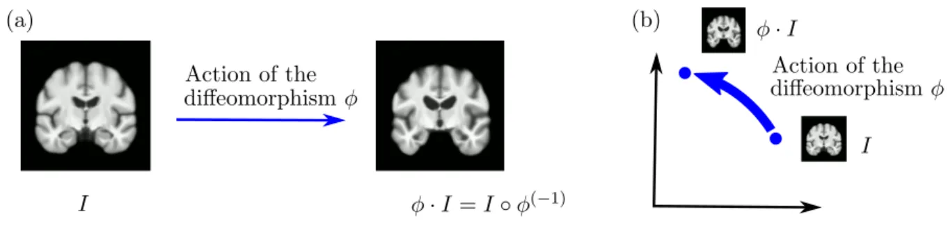 Figure 1. Action of a diffeomorphism φ on a brain image I. (a) the brain image before and after the action of φ, (b) schematic representation of the action of φ on the brain image I, represented as a dot in R 2 .