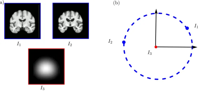 Figure 2. Orbit and isotropy group of a brain image. (a) I 1 and I 2 belong to the same orbit: I 2 is a diffeomorphic deformations of I 1 