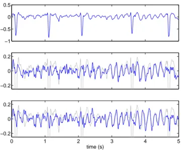 Fig. 8. Atrial activity extraction in atrial fibrillation ECGs. Top: a 5-second segment of lead V1 from the first patient of the database