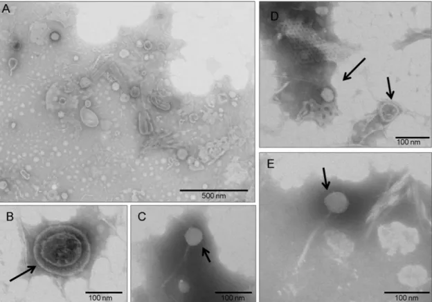 FIG 1 Transmission electron microscopy of negatively stained viral particles. (A) Overview of stained viral particles, which vary in size and shape, isolated from the Middle Ages coprolite
