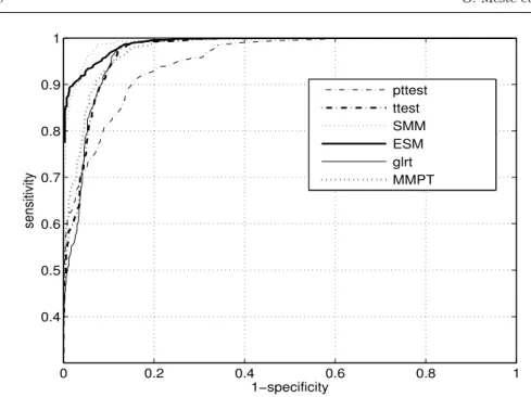 Fig. 4 Simulated ROC curves for analyzed methods. Only single frequency interference were added in the model (8)