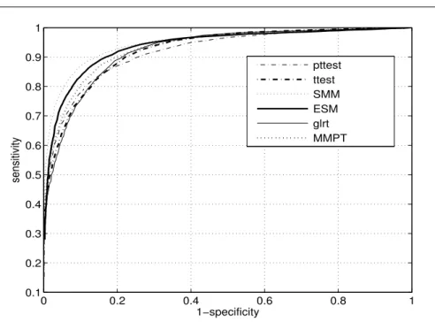 Fig. 5 Simulated ROC curves for analyzed methods. Gaussian noise and single frequency interference were added in the model (8)