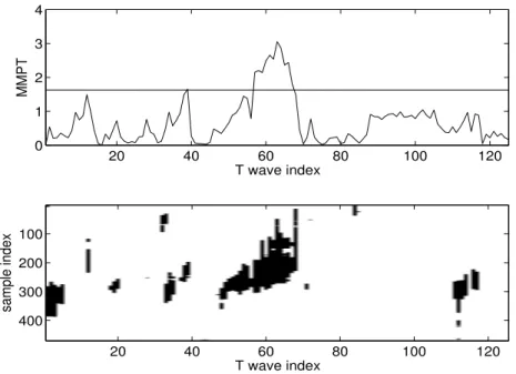Fig. 6 Upper part: M M P T method output for a given patient (Y lead) where the sequence is the average in time of the T-wave (M pre-processing)