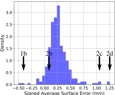 Fig. 1: Distribution of the signed Average Surface Error (ASE) on the training set of the BRATS 2017 challenge, with references to the figures presented in the article