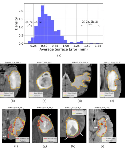 Fig. 2: Study of the training set of the BRATS 2017 challenge. Distribution of the Average Surface Error (ASE) (2a)