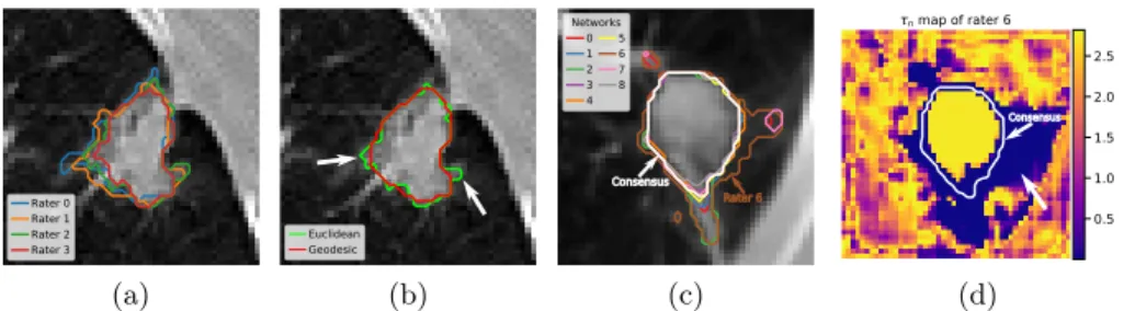 Fig. 3. Geodesic vs. Euclidean distance on radiologists’ delineations from LIDC (3a and 3b)