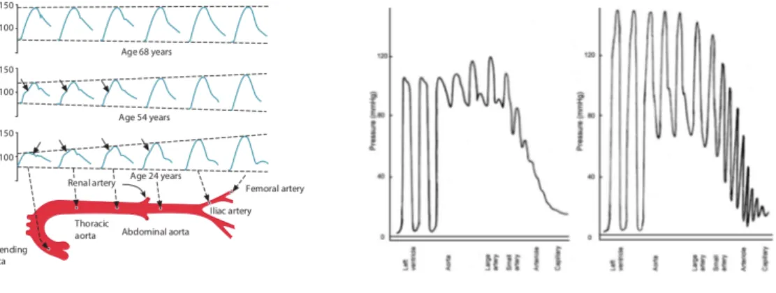 Fig. 2.5.: a) Pulse pressure wave propagation along the main arteries, reflection, refraction, and interference distort the pressure waveform