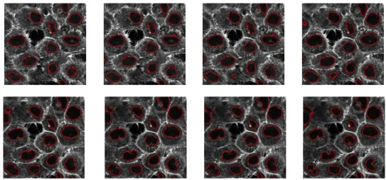 Figure 3: Segmentation of nuclei made on upper (upper row) and lower (bottom row) slices of the all stack, mid-slice of Fig
