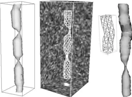 Fig. 7. Simulation of stent/vessel-wall interaction in a physical phantom of stenosed vessel