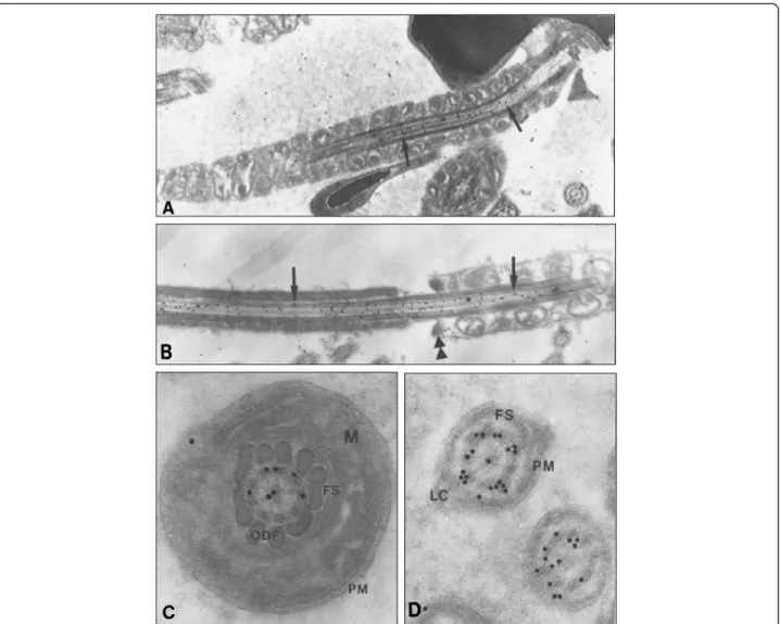 Fig. 2 Immunogold electron micrographs of Nardilysin in wild-type mouse in late spermatids