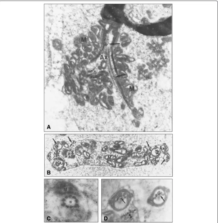 Fig. 4 Immunogold electron micrographs of Nardilysin in the caput epididymis of mutant mouse ( ebo/ebo ) spermatozoa