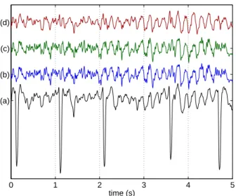 Fig. 2. Frequency spectra of the signals in Fig. 1. Values on the left: