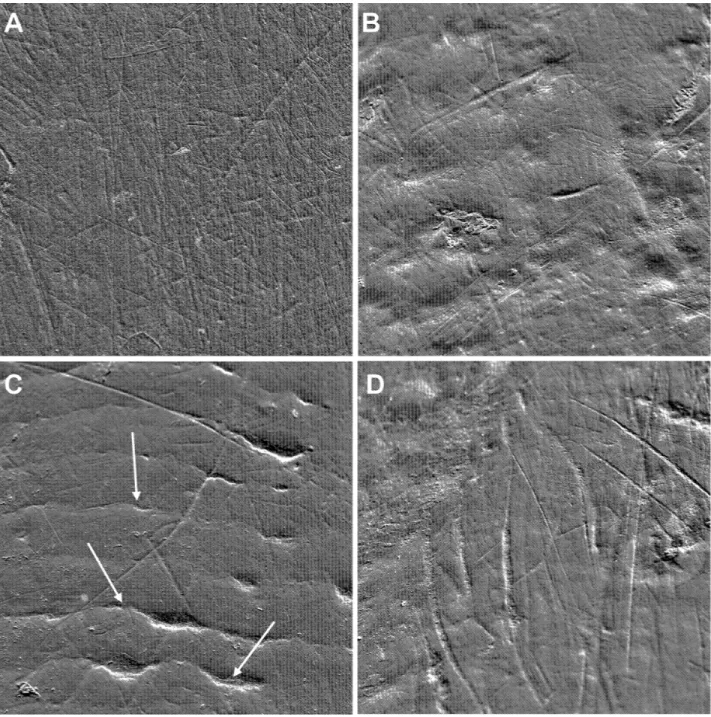 Fig 1. Buccal tooth surfaces (0.45 mm 2 ) of mandrills from the studied population. The different SEM micrographs show different microwear patterns with (A) no evident artifacts; (B) some artifacts: patina layers and patches of erosion characterized by gro