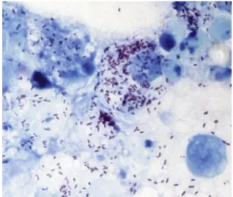 FIG. 1. XTC-2 cell line infected with Candidatus Rickettsia senegalensis, strain PU01-02, seventh day post-inoculation, Gimenez staining, 1500×.