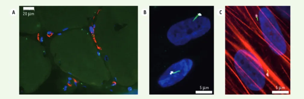 Figure 1. Les myofibroblastes sont ciliés in vivo et in vitro. A. Coupe transversale de muscle dystrophique et marquages immunocytochimiques