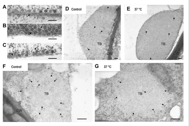 Figure 7. Electron microscopy of the different TB morphs. (A–C) Mixed-networks display virus particles on microtubules