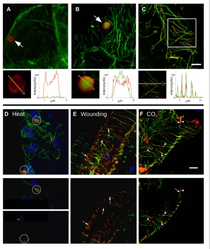 Figure 2. Stress induces different TB morphs. (A–C) The three TB morphs. Immunofluorescence of infected leaves against P2 (red) and  α -tubulin (green),  with co-labeling appearing as yellow/orange, reveals the different TB forms: (A) a tubulin-less TB (ar