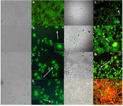 Figure 4. Effect of WAE extract of C. coriaria extract and pure compounds on cell death in Hep3B cells  by epifluorescence microscopy