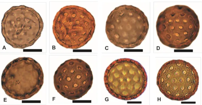 Fig. 2. Light microscope images of pollen grains of selected Salicornioideae taxa in two focal levels  to show both exine structures and pore characteristics