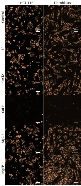 Figure 6. Drastic mitochondrial membrane potential alteration 5 min after electroporation associated  with 5 mM calcium