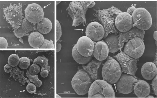 Figure 9.  SEM showing the interaction between uninfected A. castellanii cells and tupanvirus-induced  bunches