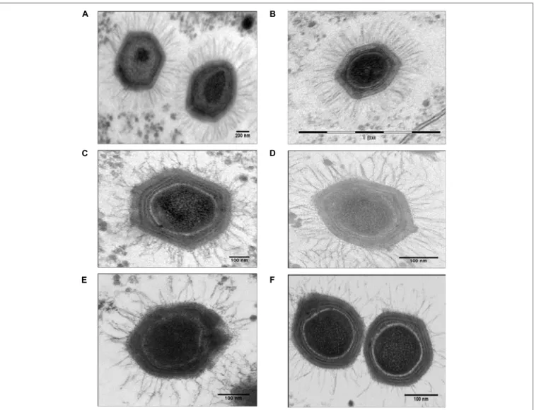 FIGURE 2 | Electron micrographs of control Mimivirus and Mimivirus after knocking down genes encoding fiber associated proteins (FAPs)