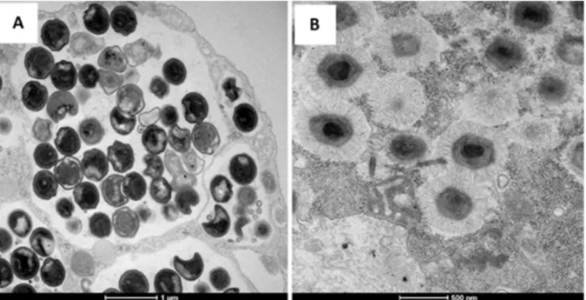 Figure 1. Transmission electron microscopy of the Chlamydia bacterium (A) and Mimivirus (B).