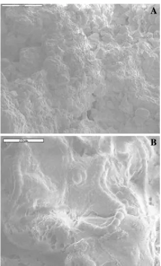 Fig. 3 SEM micrographs of the soil surface. Sample inoculated for 4 weeks. (A) General view  of the surface