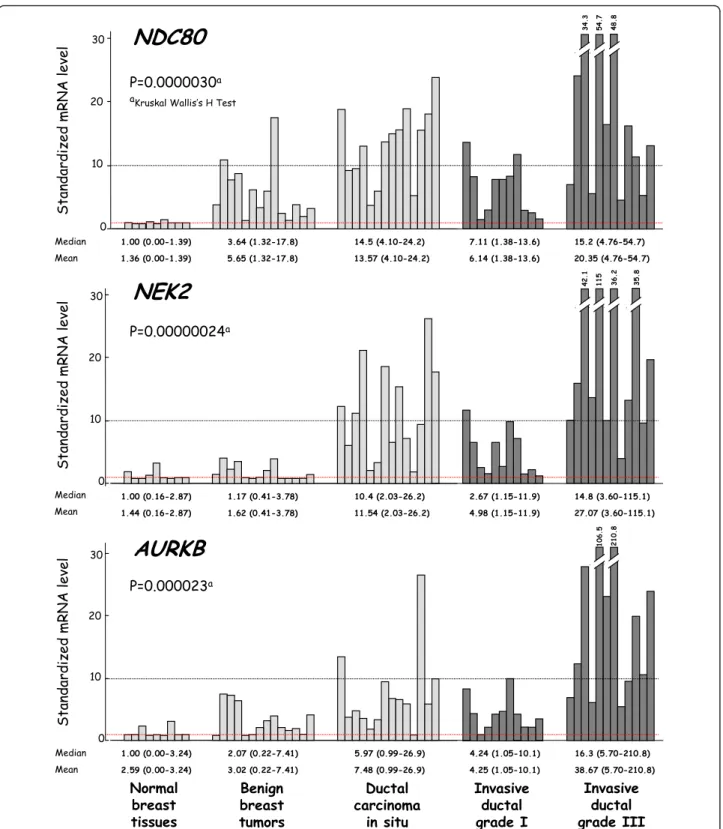 Figure 1 mRNA levels of 3 characteristic upregulated genes (NDC80, NEK2 and AURKA) according to breast tumor progression