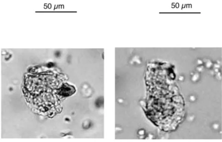 Fig. 3. Microphotographs of modern (left) and fossil (right) spherical-with- spherical-with-sockets pine morphotype