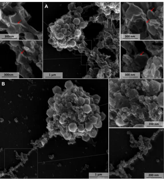 FIG 3 Scanning microscopy of a disrupted mimivirus viral factory. (A) Lamellar structures related to capsid morphogenesis.